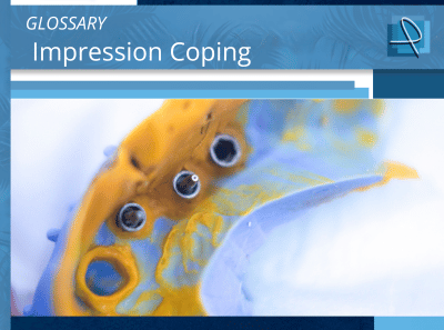 What Is an Impression Coping? | Pro-Craft