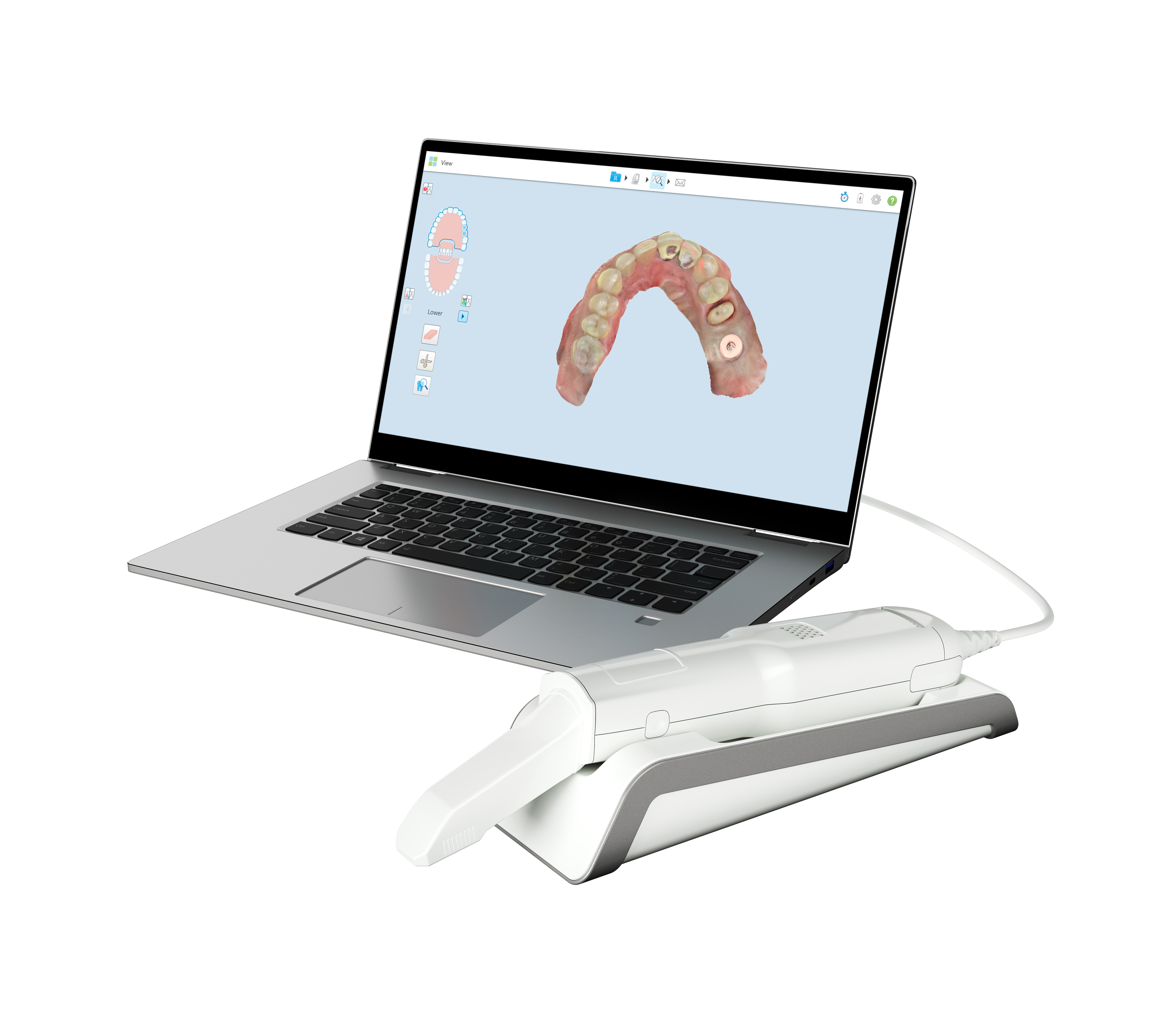 iTero_ElementFlex_3-4_Lft_Wht_BG_crown_and_implant_crown_occlusal_prep (2)